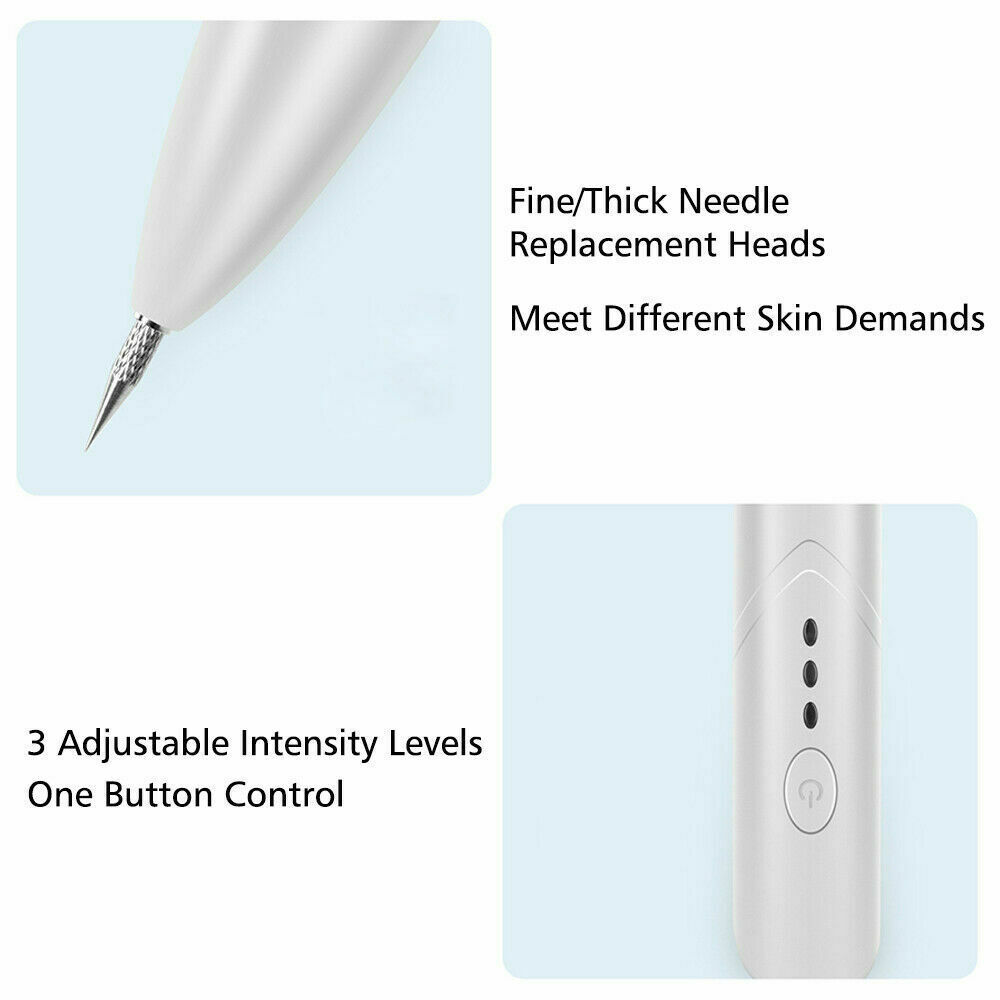 Ion Laser Skin Mole & Dark Spot Remover Pen – Freckle, Wart & Tag Removal Device