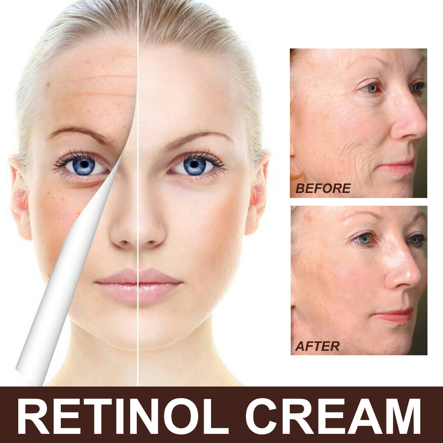 EELHOE Retinol Anti-Aging-Creme – Faltenentfernung und Hautstraffung mit Hyaluronsäure und Vitamin