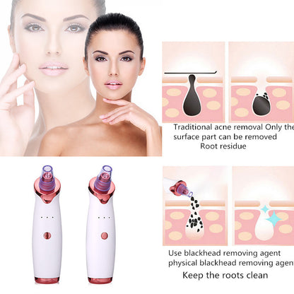 Blackhead Remover Vacuum: Deep Pore Cleansing Tool