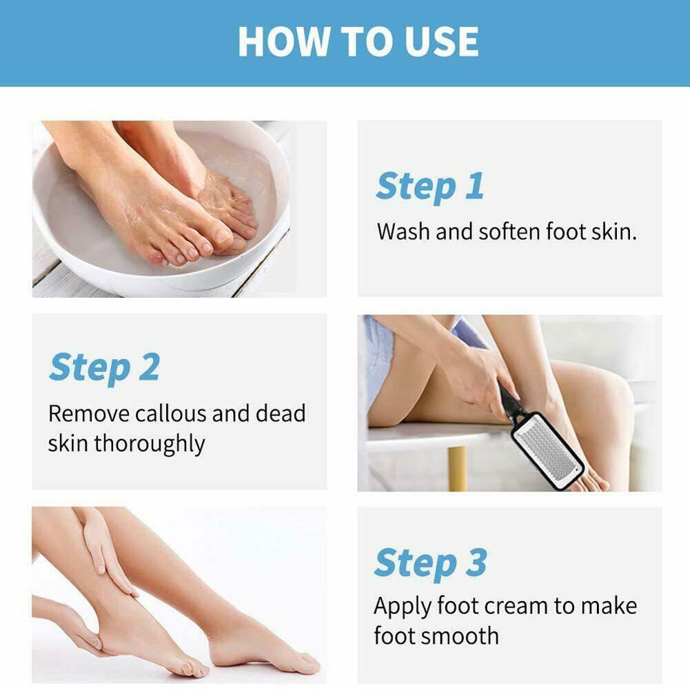 Professional Foot Callus Remover – Pedicure Tool for Cracked & Rough Skin