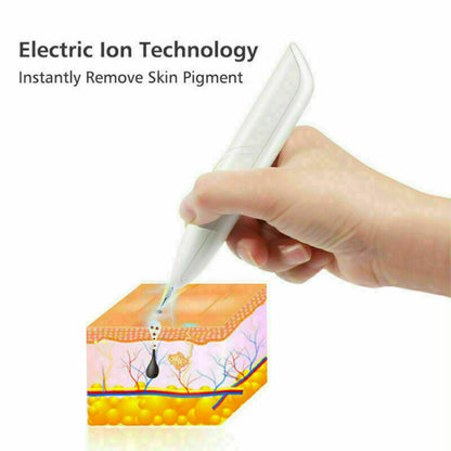 Ion Laser Skin Mole & Dark Spot Remover Pen – Freckle, Wart & Tag Removal Device