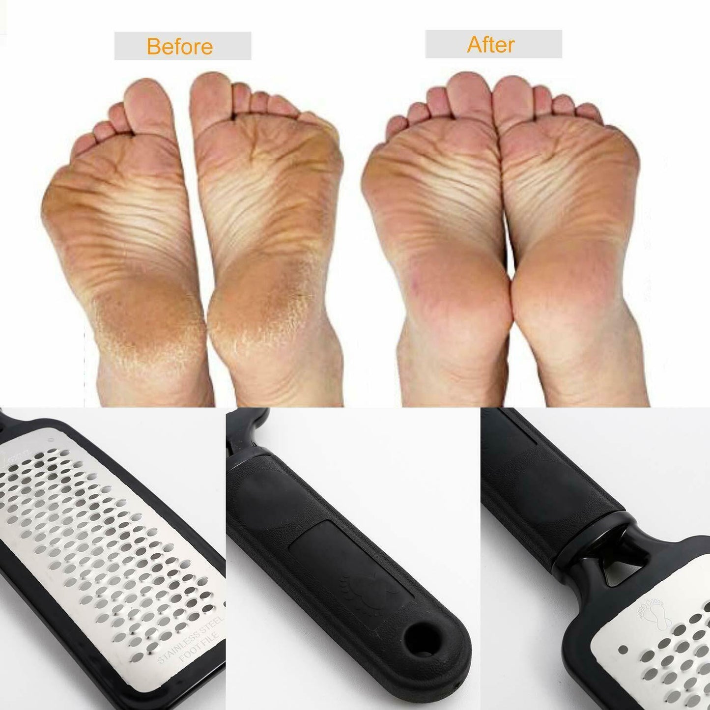 Professional Foot Callus Remover – Pedicure Tool for Cracked & Rough Skin