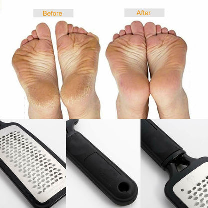 Professional Foot Callus Remover – Pedicure Tool for Cracked & Rough Skin