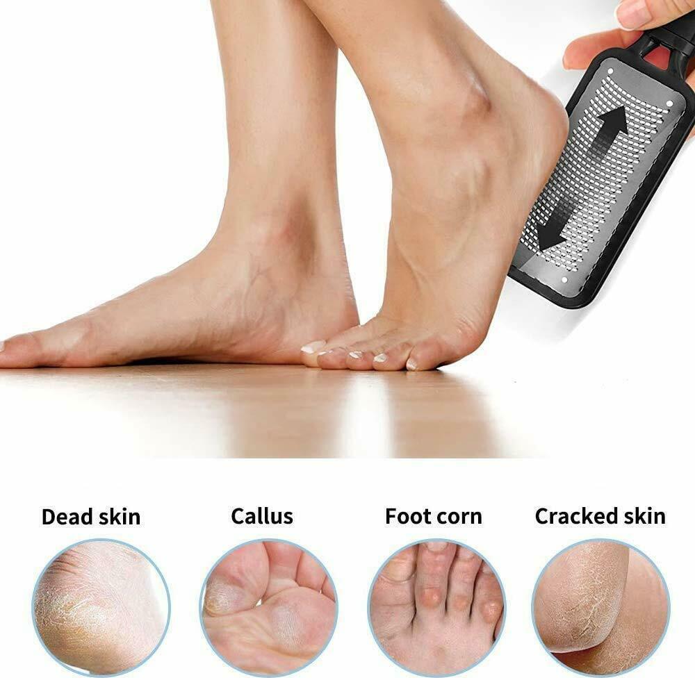 Professional Foot Callus Remover – Pedicure Tool for Cracked & Rough Skin