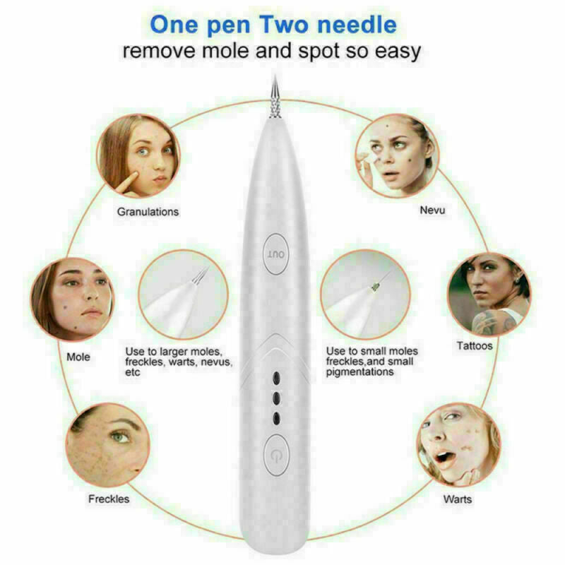 Ion Laser Skin Mole & Dark Spot Remover Pen – Freckle, Wart & Tag Removal Device