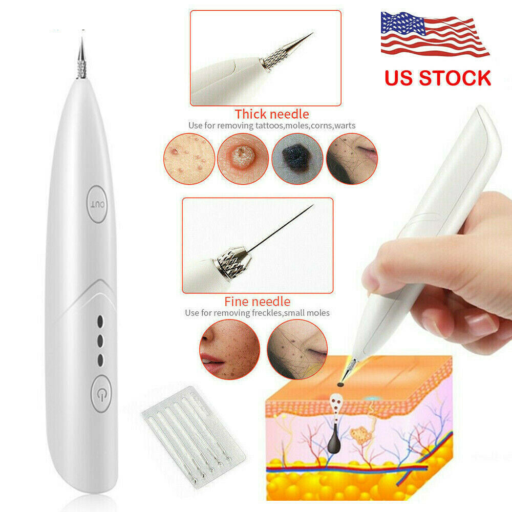 Ion Laser Skin Mole & Dark Spot Remover Pen – Freckle, Wart & Tag Removal Device