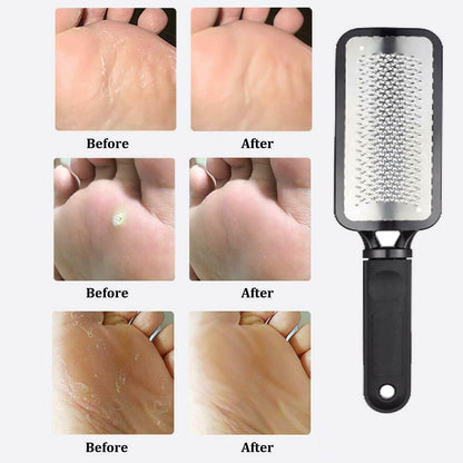 Professional Foot Callus Remover – Pedicure Tool for Cracked & Rough Skin